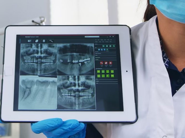 3D Dental XRay in Ahwatukee, Phoenix 3D Xray