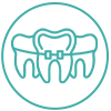 Orthodontics and Invisalign