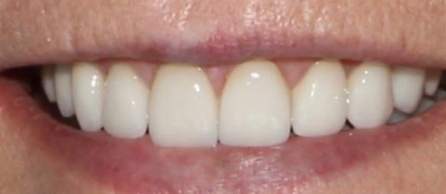 Atrium Dental Before and after dentistry in Phoenix, AZ