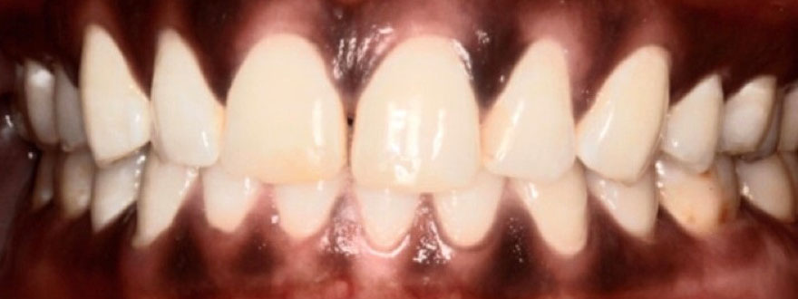 Atrium Dental Before and after dentistry in Phoenix, AZ