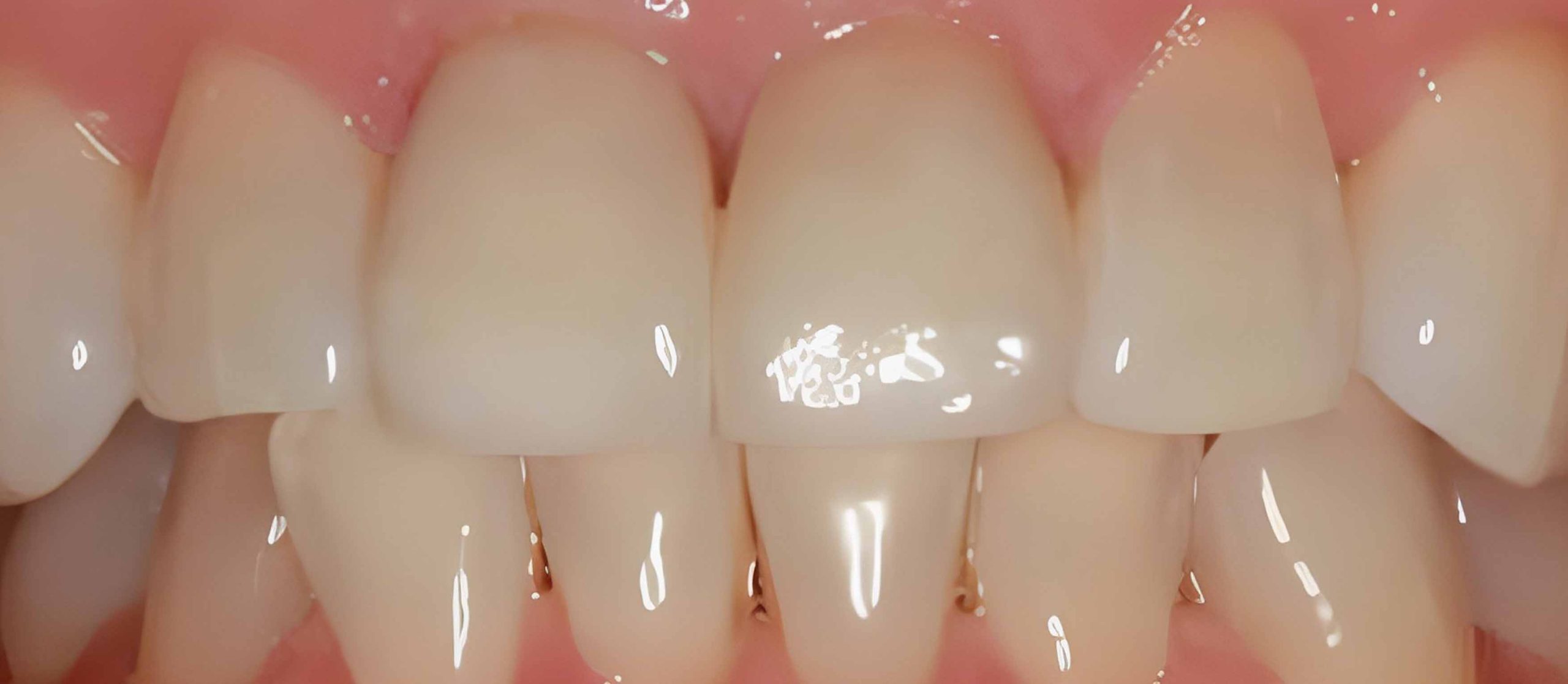 Before & After Whitening Services