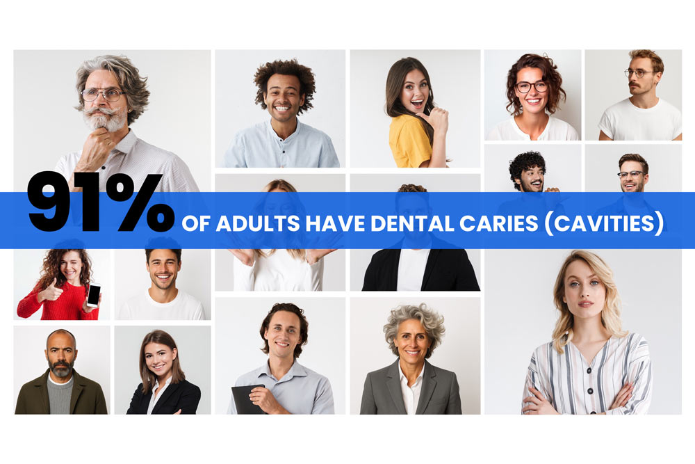 What Percentage of People Have Fillings