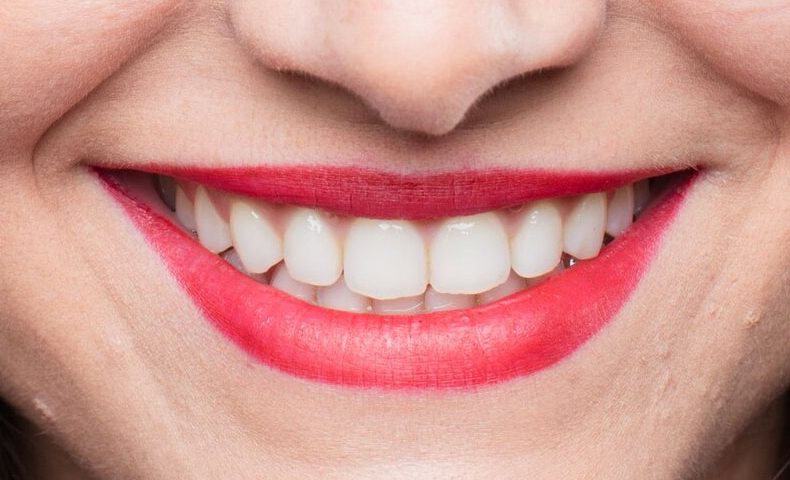 How Much is Teeth Whitening at the Dentist in Phoenix, Arizona
