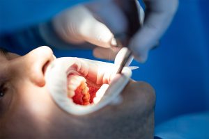 What is the Difference Between Prosthesis and Prosthodontics