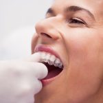 Is 20 Hours Enough for Invisalign