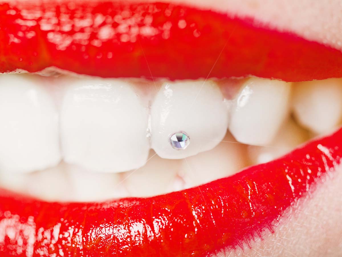 Can You Eat with Cosmetic Teeth