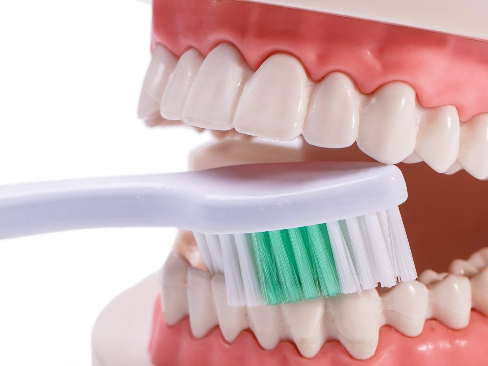 How to Keep Dental Implants Clean