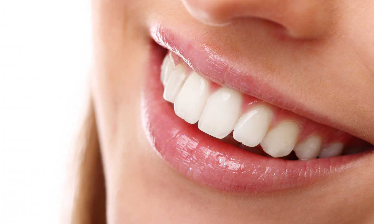 How Much Does Full Mouth Porcelain Veneers Cost?
