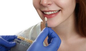 Are Porcelain Veneers Permanent?