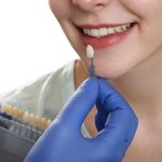 What Are the Key Differences Between No-Prep Veneers and Traditional Veneers?