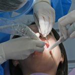 7 Signs of Infection After Gingivectomy