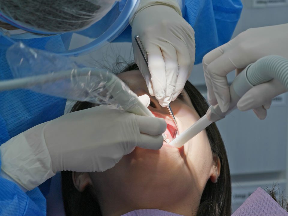 7 Signs of Infection After Gingivectomy