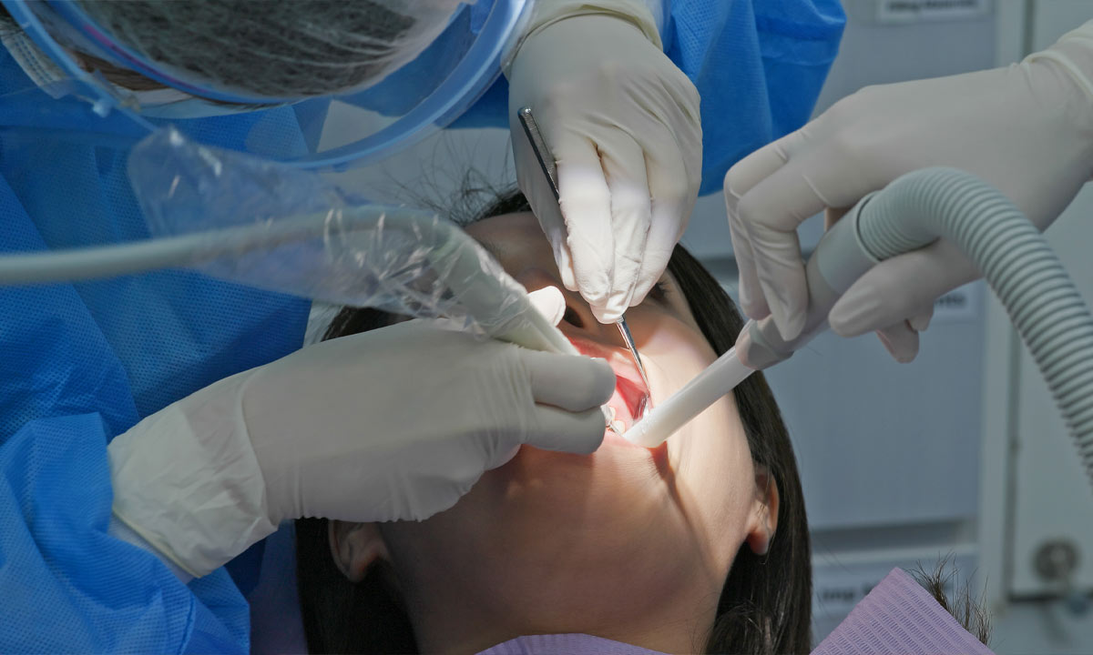 7 Signs of Infection After Gingivectomy