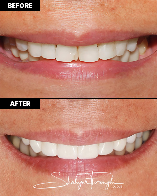 Atrium Dental - Before After