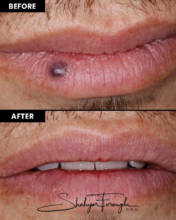 Atrium Dental - Before After