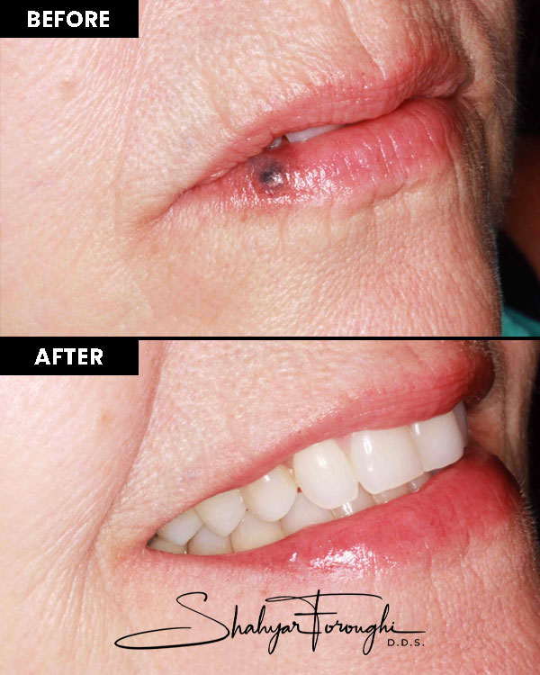 Atrium Dental - Before After