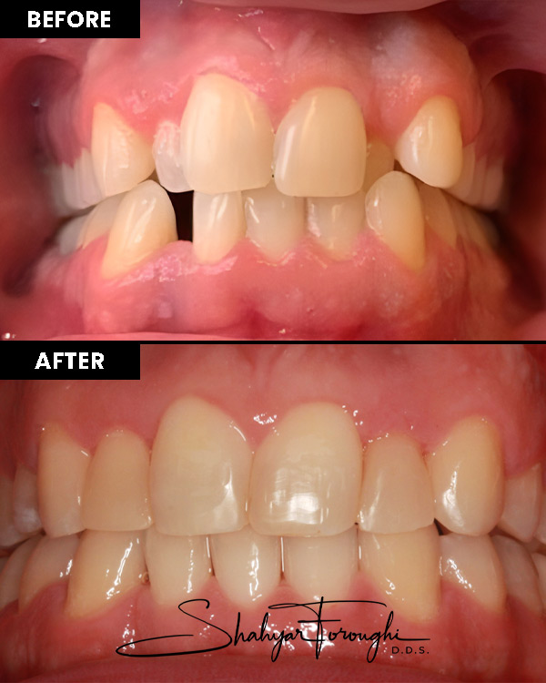 Atrium Dental - Before After