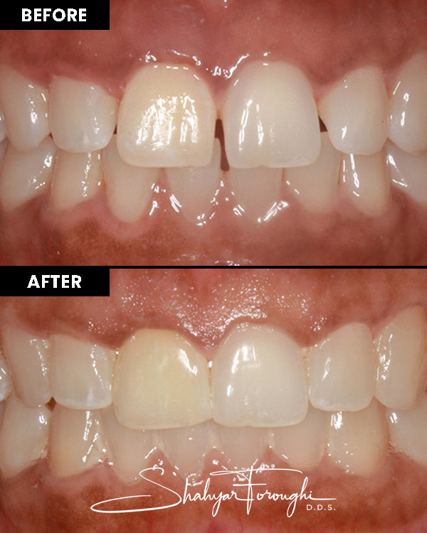 Atrium Dental - Before After
