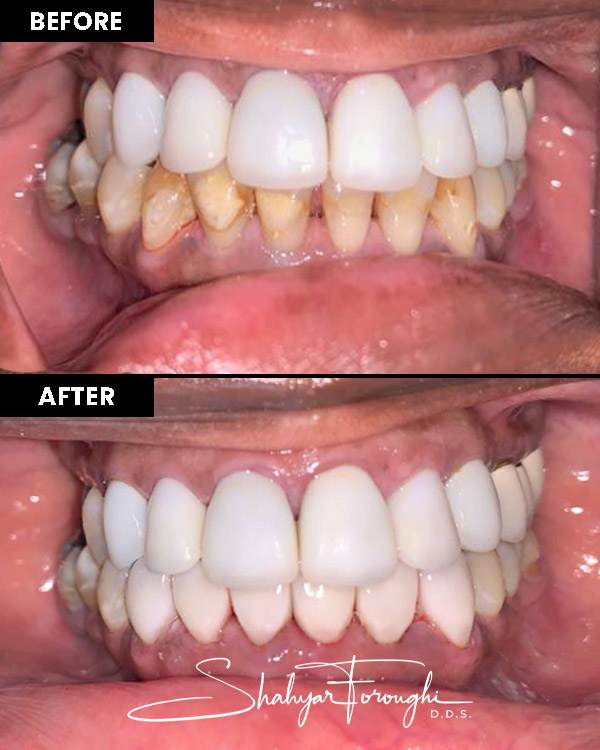 Atrium Dental - Before After