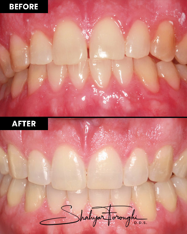 Atrium Dental - Before After