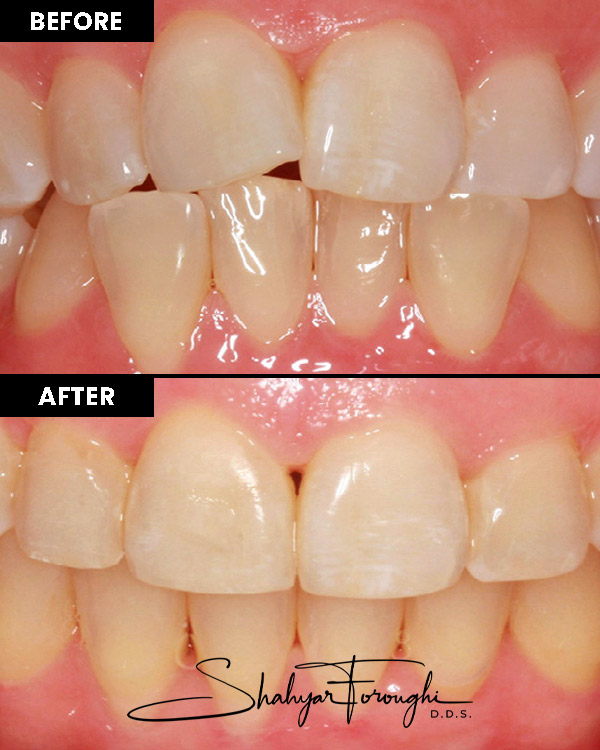 Atrium Dental - Before After