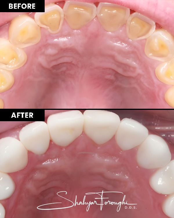 Atrium Dental - Before After