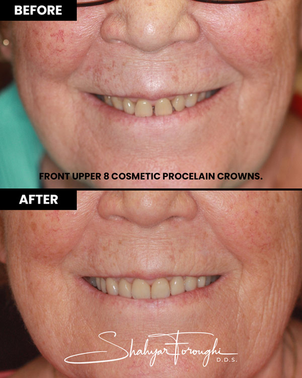 Atrium Dental - Before After