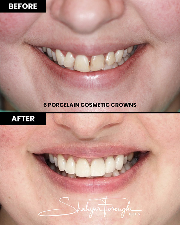 Atrium Dental - Before After