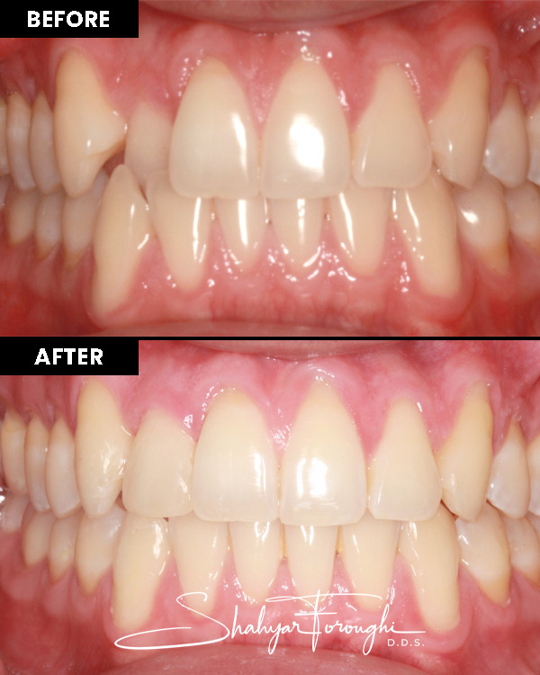 Atrium Dental - Before After