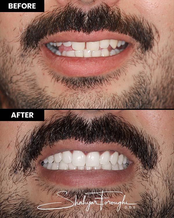 Atrium Dental - Before After