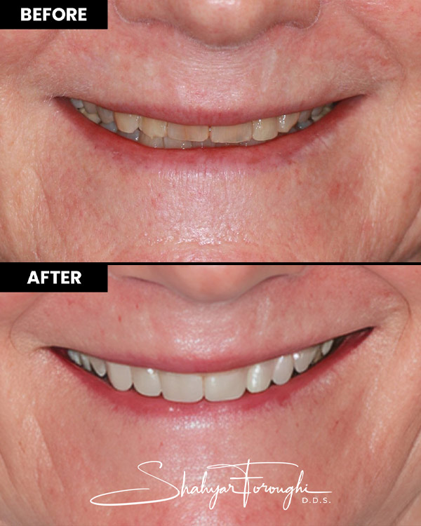 Atrium Dental - Before After