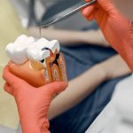 7 Warning Signs You Need a Root Canal