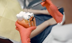 7 Warning Signs You Need a Root Canal