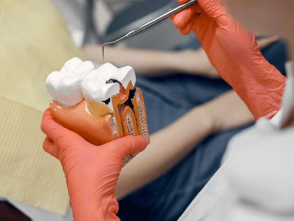 7 Warning Signs You Need a Root Canal