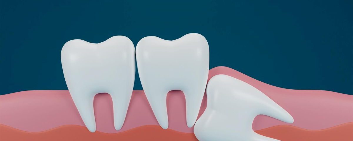 Can Wisdom Teeth Grow Back?