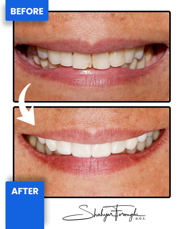 Cosmetic Landing - Before After