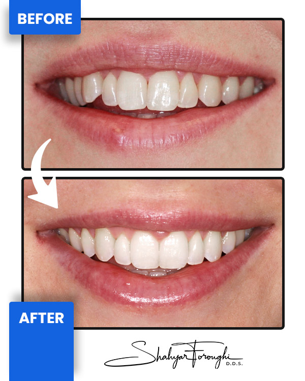 Cosmetic Landing - Before After