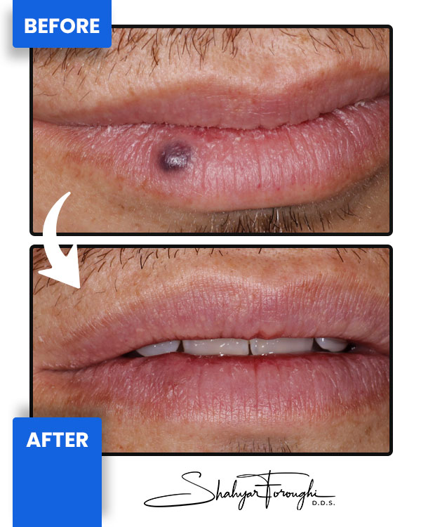 Cosmetic Landing - Before After