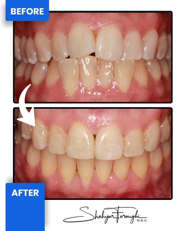 Cosmetic Landing - Before After