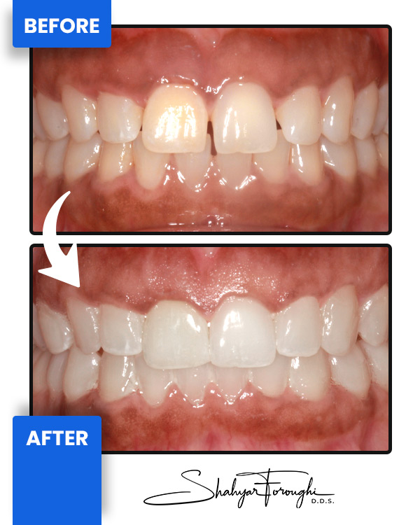 Cosmetic Landing - Before After