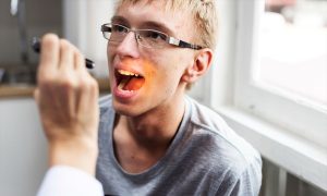 How Fast Does Oral Cancer Spread?