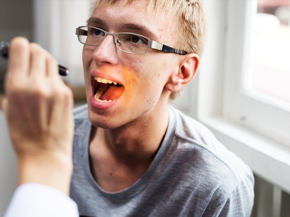 How Fast Does Oral Cancer Spread?
