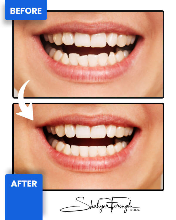 Smile Gallery - Smile Promotions