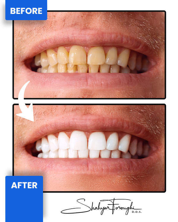 Smile Gallery - Smile Promotions