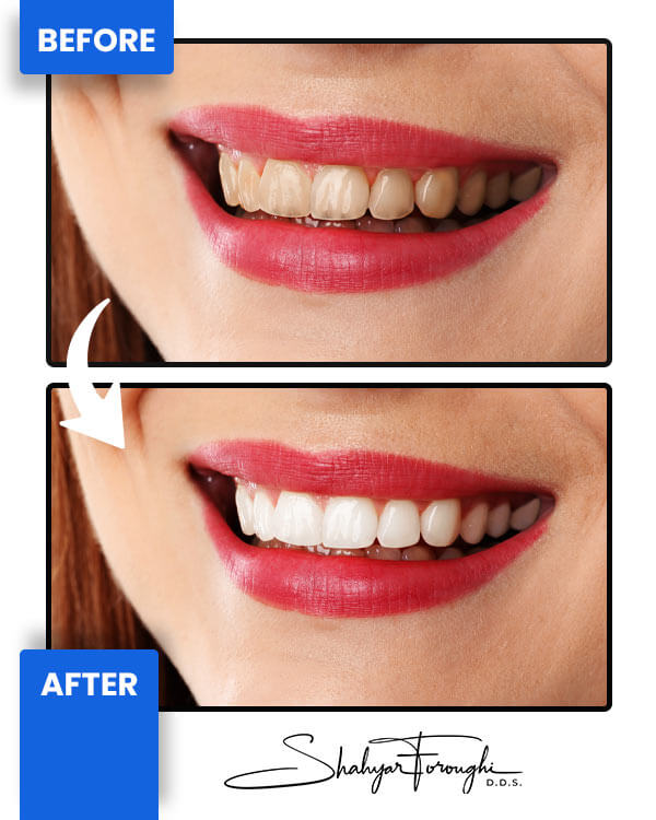 Smile Gallery - Smile Promotions