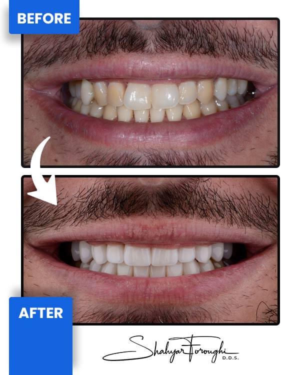 Smile Gallery - Smile Promotions