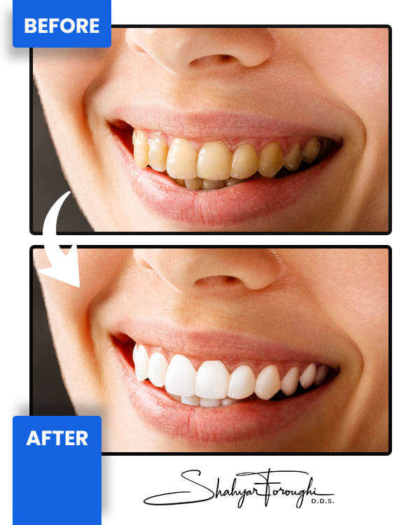 Smile Gallery - Smile Promotions
