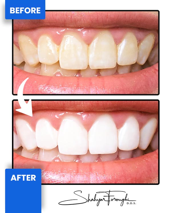 Smile Gallery - Smile Promotions