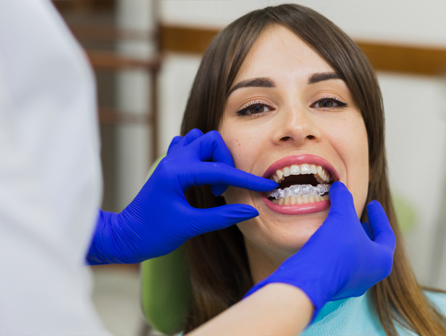Whitening Trays