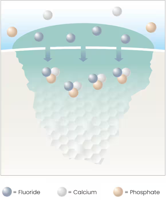 Benefits of Curodont Treatment